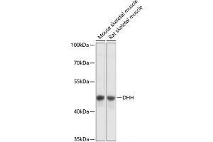 Western blot analysis of extracts of various cell lines using DHH Polyclonal Antibody at dilution of 1:3000.