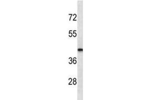 LHX2 antibody western blot analysis in MDA-MB435 lysate. (LHX2 anticorps)