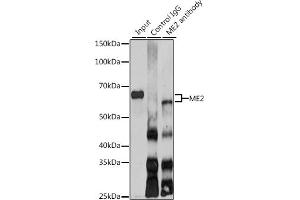 Immunoprecipitation analysis of 200 μg extracts of SKOV3 cells using 3 μg ME2 antibody (ABIN6133037, ABIN6143674, ABIN6143675 and ABIN6225057).