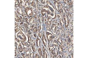 IHC analysis of SCO1 using anti-SCO1 antibody (ABIN7600609). (SCO1 anticorps  (AA 21-301))