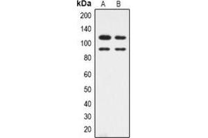 Western blot analysis of CDK11B expression in HepG2 (A), Hela (B) whole cell lysates.