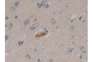 Detection of CYP-40 in Human Brain Tissue using Polyclonal Antibody to Cyclophilin 40 (CYP-40)