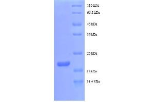SDS-PAGE (SDS) image for Colony Stimulating Factor 2 (Granulocyte-Macrophage) (CSF2) (AA 27-200), (partial) protein (His tag) (ABIN5712476)
