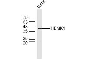 Mouse testis lysates probed with HEMK1 Polyclonal Antibody, Unconjugated  at 1:300 dilution and 4˚C overnight incubation. (HEMK1 anticorps  (AA 21-120))