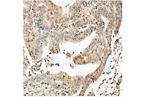 IHC analysis of Ch TOG/CKAP5 using anti-Ch TOG/CKAP5 antibody (ABIN7599106). (CKAP5 anticorps  (AA 1-221))