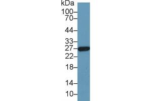 Detection of GSTa5 in Human Liver lysate using Polyclonal Antibody to Glutathione S Transferase Alpha 5 (GSTa5) (GSTa5 anticorps  (AA 1-221))