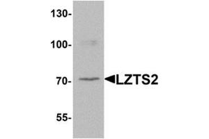 Western blot analysis of LZTS2 in human kidney tissue lysate with LZTS2 Antibody  at 1 μg/ml. (LZTS2 anticorps  (N-Term))