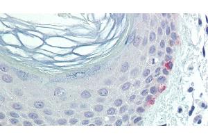 Immunohistochemistry of paraffin-embedded Skin tissue using TYR Polyclonal Antibody at dilution of 1:100 . (TYR anticorps)