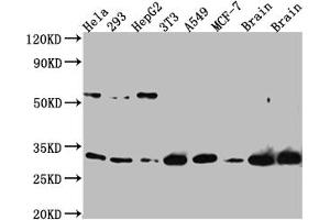 Western Blot Positive WB detected in: Hela whole cell lysate, 293 whole cell lysate, HepG2 whole cell lysate, NIH/3T3 whole cell lysate, A549 whole cell lysate, MCF-7 whole cell lysate, Mouse Brain whole cell lysate, Rat Brain whole cell lysate All lanes: PGAM1 Antibody at 1:1000 Secondary Goat polyclonal to rabbit IgG at 1/50000 dilution Predicted band size: 28 kDa Observed band size: 29 kDa (Recombinant PGAM1 anticorps)