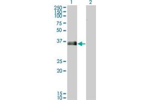 Western Blot analysis of MARCKSL1 expression in transfected 293T cell line by MARCKSL1 monoclonal antibody (M02), clone 8C8.