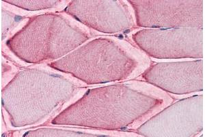 Human Skeletal Muscle: Formalin-Fixed, Paraffin-Embedded (FFPE) (SLC1A5 anticorps  (Internal Region))