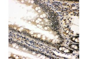 IHC analysis of nmt55/p54nrb using anti-nmt55/p54nrb antibody (ABIN3044530).