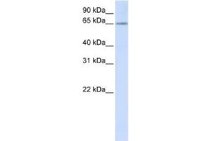 RSPRY1 antibody used at 1 ug/ml to detect target protein. (RSPRY1 anticorps  (N-Term))