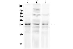 Western blot analysis of FGF8 using anti-FGF8 antibody . (FGF8 anticorps  (AA 23-233))