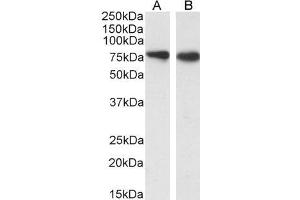 ABIN5539615 (0. (SLC26A6 anticorps  (Internal Region))