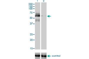 Western blot analysis of RAD18 over-expressed 293 cell line, cotransfected with RAD18 Validated Chimera RNAi (Lane 2) or non-transfected control (Lane 1). (RAD18 anticorps  (AA 332-430))