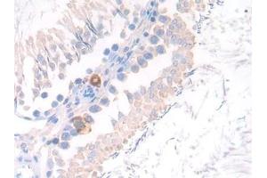 Detection of CD10 in Rat Testis Tissue using Polyclonal Antibody to Neprilysin (CD10)