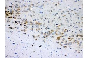 IHC testing of FFPE rat brain tissue with RPS6 antibody at 1ug/ml.