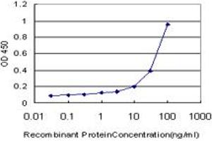 ELISA image for anti-Malonyl CoA:ACP Acyltransferase (Mitochondrial) (MCAT) (AA 291-391) antibody (ABIN599223)