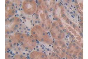 IHC-P analysis of Mouse Kidney Tissue, with DAB staining. (IL5RA anticorps  (AA 41-203))