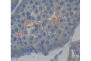 Figure. (ADAM6A anticorps  (AA 419-664))