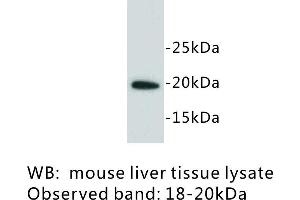 Image no. 1 for anti-Lymphocyte Antigen 6 Complex, Locus A (Ly6a) antibody (ABIN1112928)