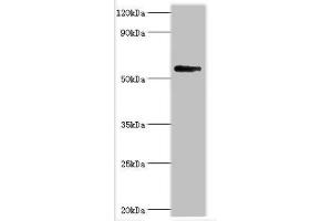 Western blot All lanes: Bromodomain-containing protein 9 antibody at 2 μg/mL + Mouse liver tissue Secondary Goat polyclonal to rabbit IgG at 1/10000 dilution Predicted band size: 68, 23, 54, 27, 56, 61 kDa Observed band size: 68 kDa (BRD9 anticorps  (AA 338-597))