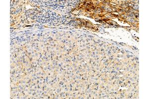 ABIN6266239 and ABIN6277380 at 1/100 staining Rat ovary tissue by IHC-P. (KISS1R anticorps  (C-Term))