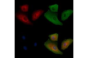 ABIN6262721 and ABIN6278917 staining  cells by IF/ICC. (KRT32 anticorps  (Internal Region))