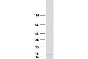 Validation with Western Blot