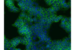 Immunocytochemistry staining of beta-catenin in humancolon adenocarcinoma cell line HT29 using EM-22 antibody (green).