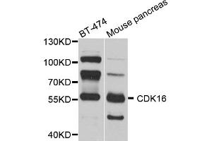 Western blot analysis of extracts of various cell lines, using CDK16 antibody. (CDK16 anticorps)