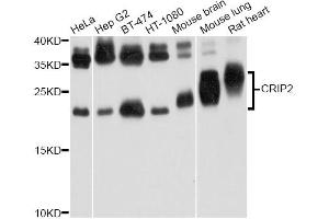 Western blot analysis of extracts of various cell lines, using CRIP2 Antibody. (CRIP2 anticorps)