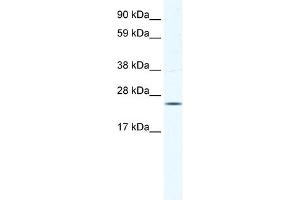 WB Suggested Anti-KCTD6 Antibody Titration:  0. (KCTD6 anticorps  (N-Term))