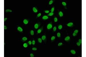 Immunofluorescence staining of A549 cells with ABIN7165027 at 1:133, counter-stained with DAPI. (AHNAK2 anticorps  (AA 195-349))