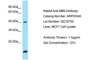 Western Blotting (WB) image for anti-Spermine Synthase, SMS (SMS) (N-Term) antibody (ABIN2789345) (SMS anticorps  (N-Term))