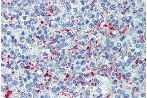 Human Spleen (formalin-fixed, paraffin-embedded) stained with SELP antibody ABIN462342 followed by biotinylated anti-mouse IgG secondary antibody ABIN481714, alkaline phosphatase-streptavidin and chromogen. (P-Selectin anticorps)