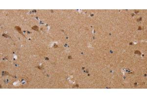 Immunohistochemistry of paraffin-embedded Human brain tissue using PLXNA4 Polyclonal Antibody at dilution 1:50