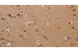 Immunohistochemistry of paraffin-embedded Human brain tissue using PLXNA4 Polyclonal Antibody at dilution 1:50 (Plexin A4 anticorps)