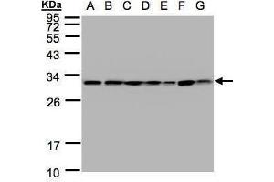 WB Image Sample(30 ug whole cell lysate) A: 293T B: A431 , C: H1299 D: HeLa S3 , E: Hep G2 , F: MOLT4 , G: Raji , 12% SDS PAGE antibody diluted at 1:1000 (14-3-3 theta anticorps  (Center))
