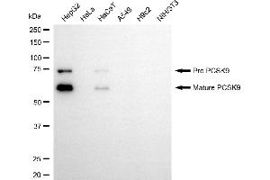 Western blotting analysis using PCSK9 antibody (ABIN7799928).