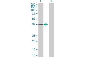 Western Blot analysis of UBE2Q2 expression in transfected 293T cell line by UBE2Q2 MaxPab polyclonal antibody. (UBE2Q2 anticorps  (AA 1-375))