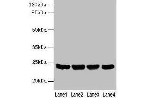 Western blot All lanes: EMC8 antibody at 4 μg/mL Lane 1: A549 whole cell lysate Lane 2: Human placenta tissue Lane 3: Hela whole cell lysate Lane 4: HT29 whole cell lysate Secondary Goat polyclonal to rabbit IgG at 1/10000 dilution Predicted band size: 24, 14 kDa Observed band size: 24 kDa (COX4NB anticorps  (AA 1-210))
