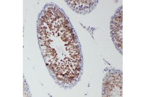 Anti-DDX4/MVH antibody, IHC(P) IHC(P): Rat Testis Tissue
