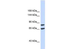 Host:  Rabbit  Target Name:  SLC26A8  Sample Type:  293T Whole Cell lysates  Antibody Dilution:  1.