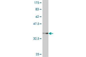 Western Blot detection against Immunogen (37 KDa) .