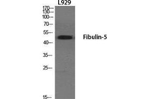 Western Blot (WB) analysis of specific cells using Fibulin-5 Polyclonal Antibody.