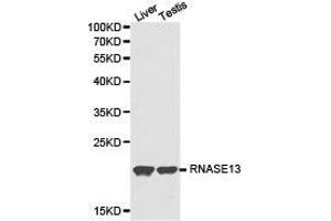 Western Blotting (WB) image for anti-Ribonuclease, RNase A Family, 13 (Non-Active) (RNASE13) antibody (ABIN1874615) (RNASE13 anticorps)