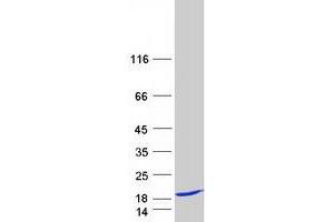 Validation with Western Blot