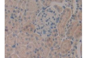 Detection of LEI in Rat Kidney Tissue using Polyclonal Antibody to Leukocyte Elastase Inhibitor (LEI)